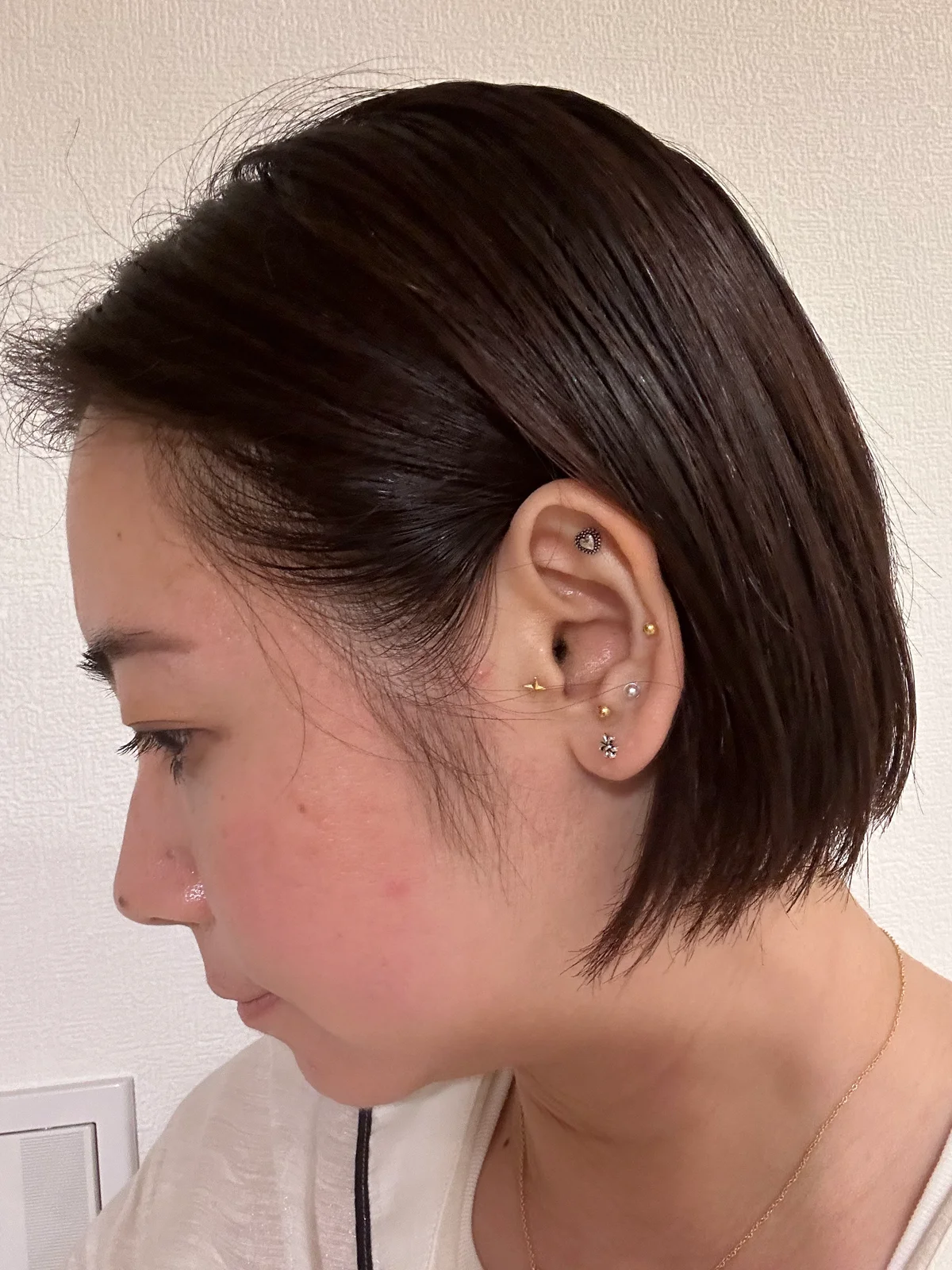 低気圧頭痛に悩む3名の対処法。鍼・耳ツボの画像_8