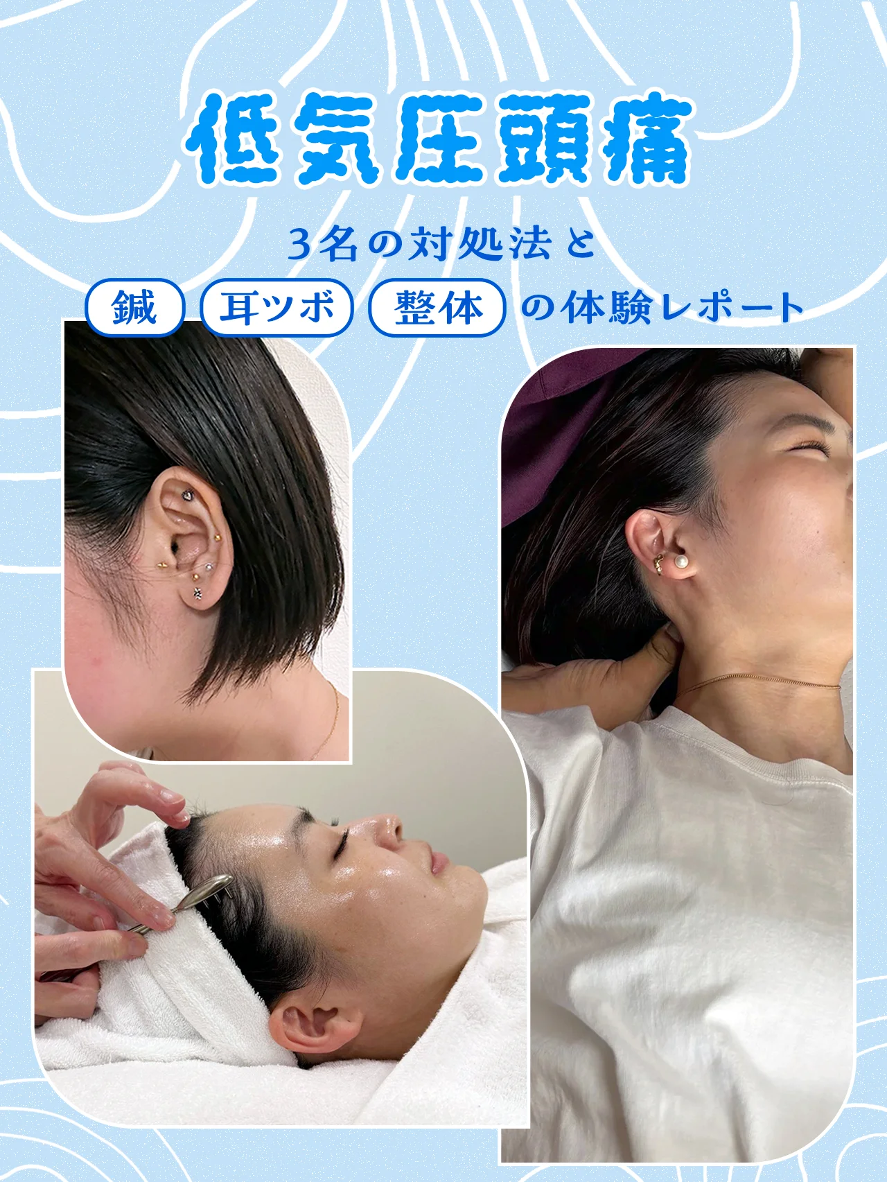 低気圧頭痛に悩む3名の対処法。鍼・耳ツボジュエリー・整体は効果的なのか？ 体験レポートも【低気圧頭痛②】