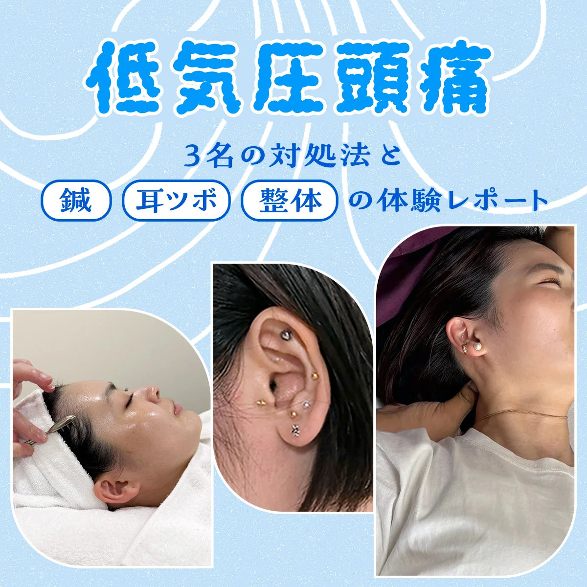 低気圧頭痛に悩む3名の対処法。鍼・耳ツボジュエリー・整体は効果的なのか？ 体験レポートも【低気圧頭痛②】